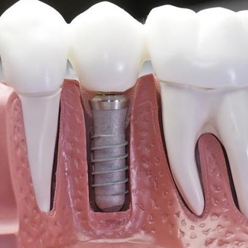 томск стоматология протезирование